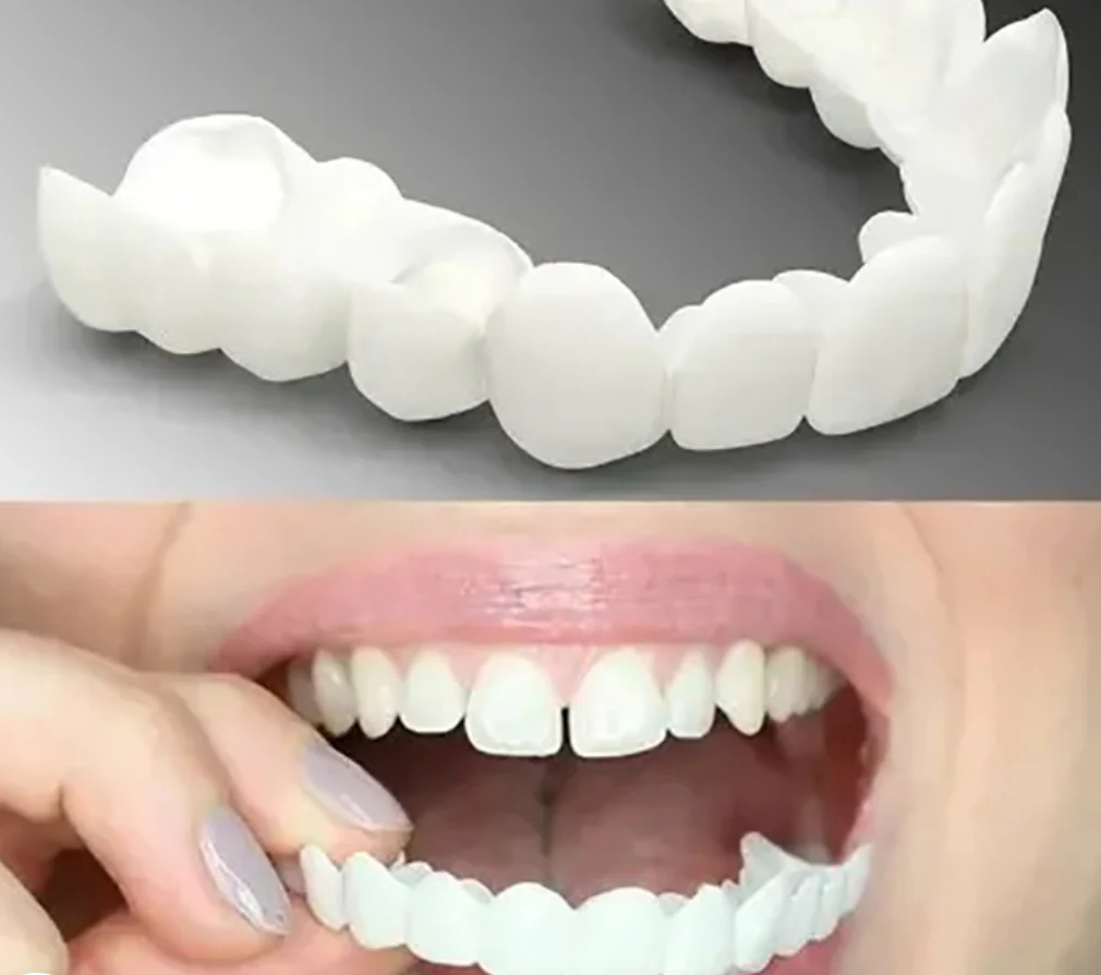 Adjustable Snap-On Dentures - Image 3