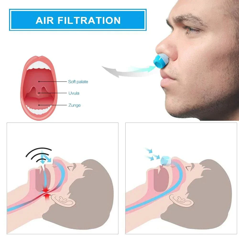 Airing Micro-CPAP Device for Hassle-Free Anti-Snoring Relief - Image 6