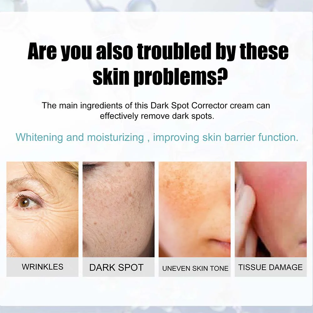 Anti-Dark Spot Skin Care Lightens Pigmentation Spots - Image 4