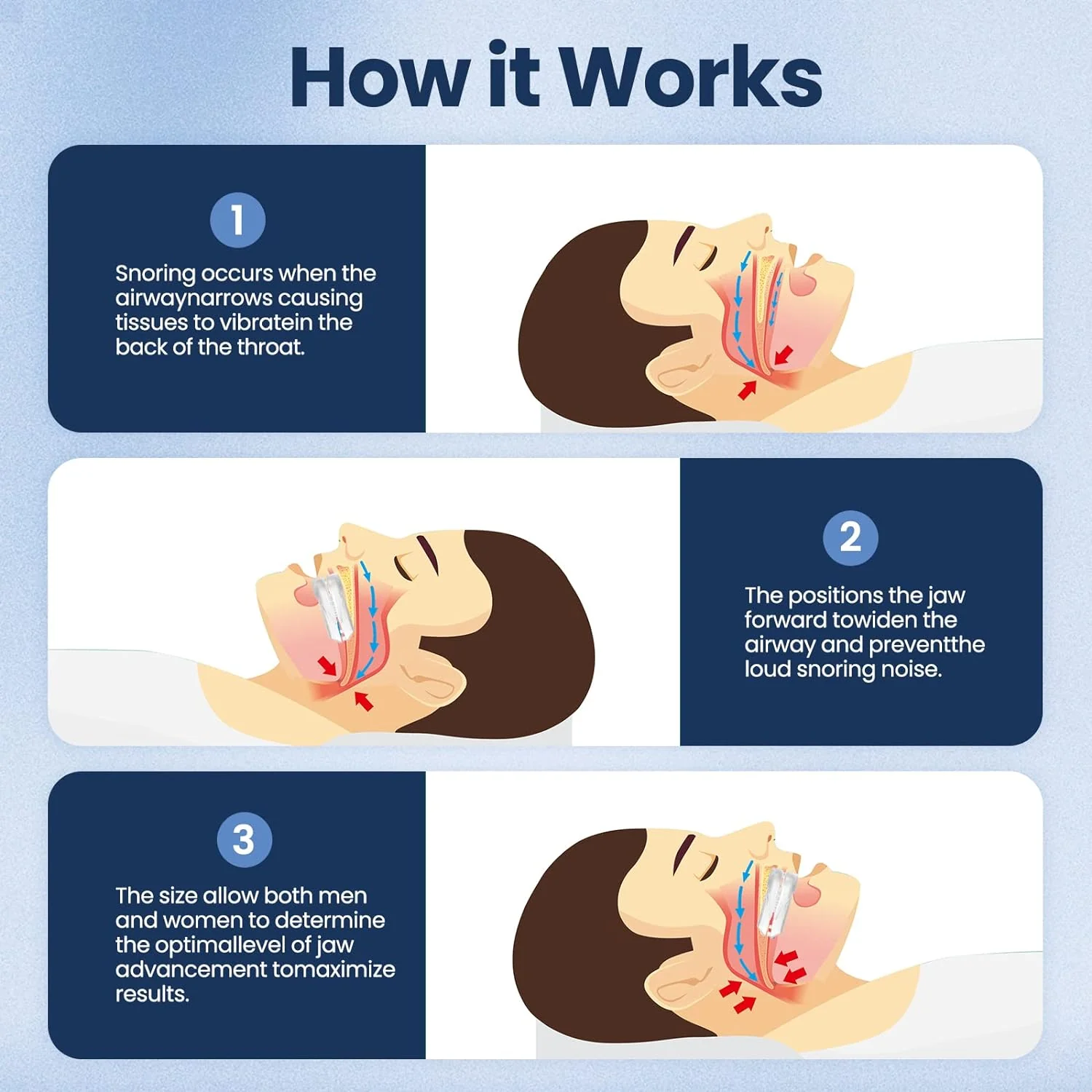 Anti-Snoring Mouthpiece Guard for Sleep Apnea - Image 5