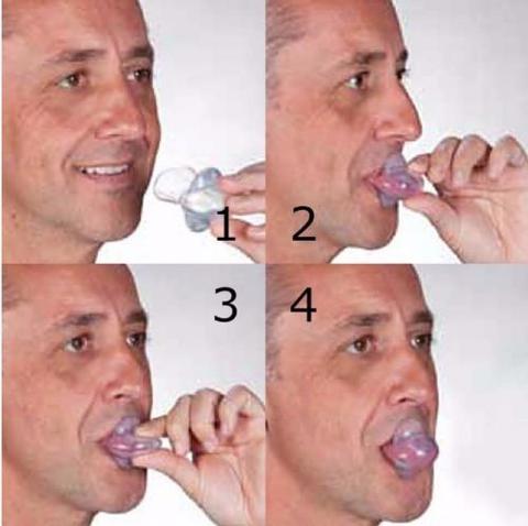 Apnea Tongue Stabilizing Device - Image 3