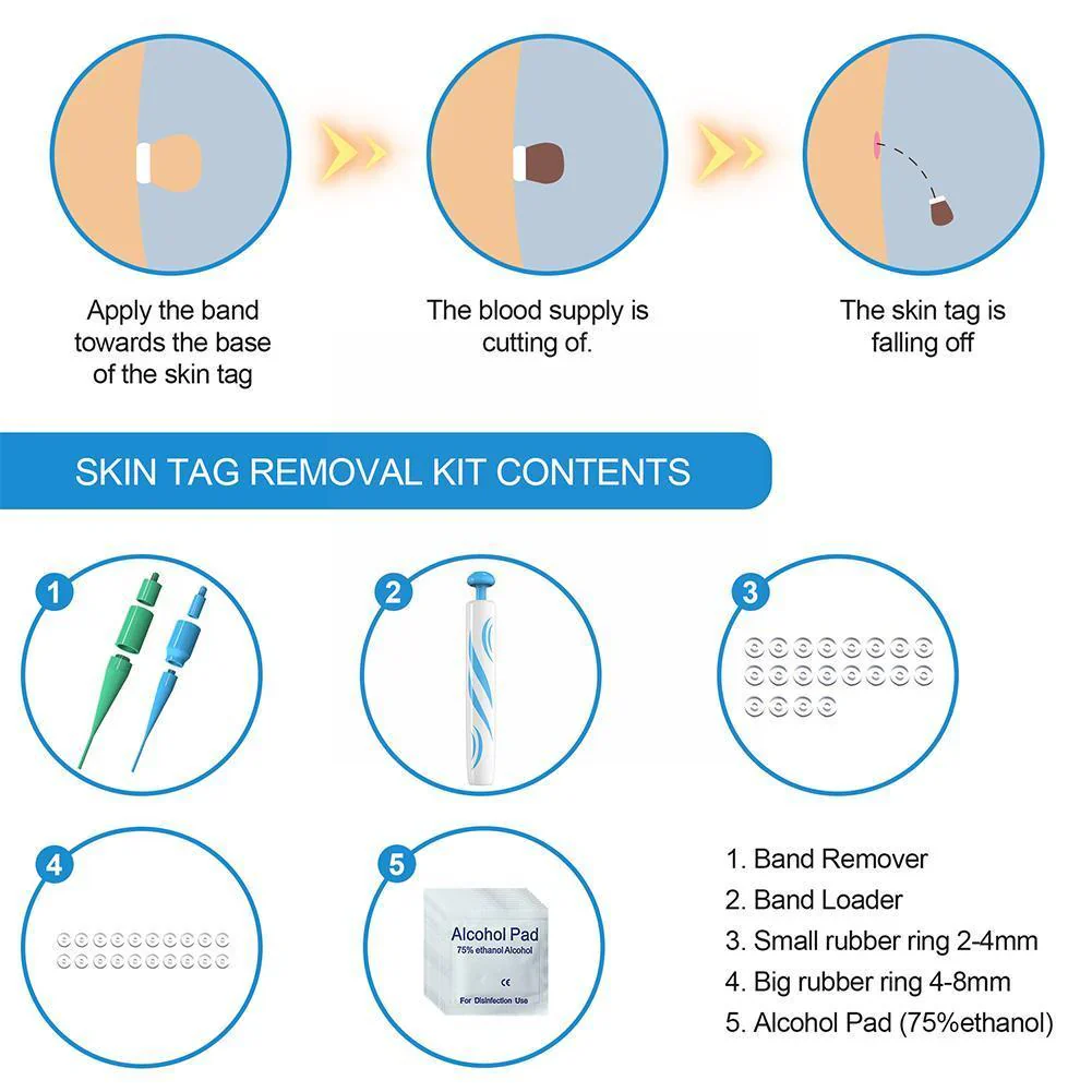 Auto Skin Tag Remover Painless - Image 4