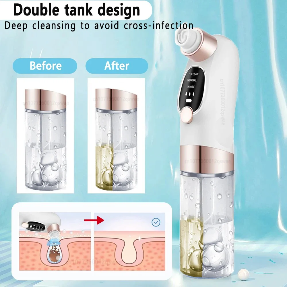 Blackhead Remover Tool - Image 5