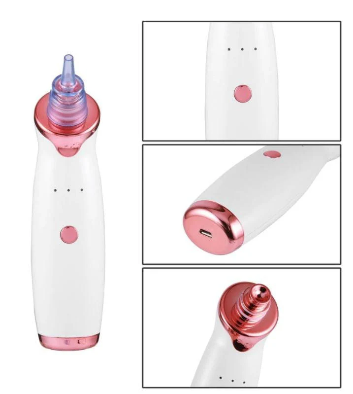 Blackhead Vacuum Cleaner - Image 6