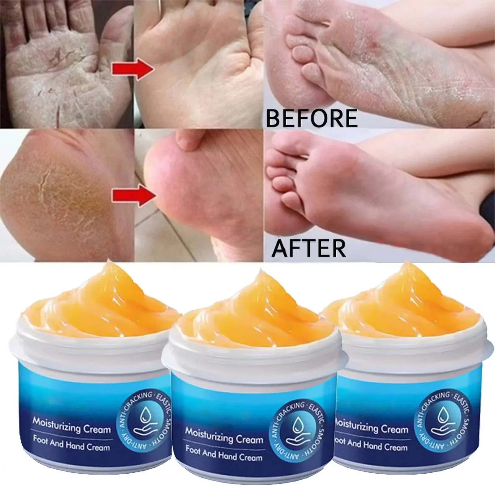 Cracked Foot Heel Treatment 3 Pack - Image 7