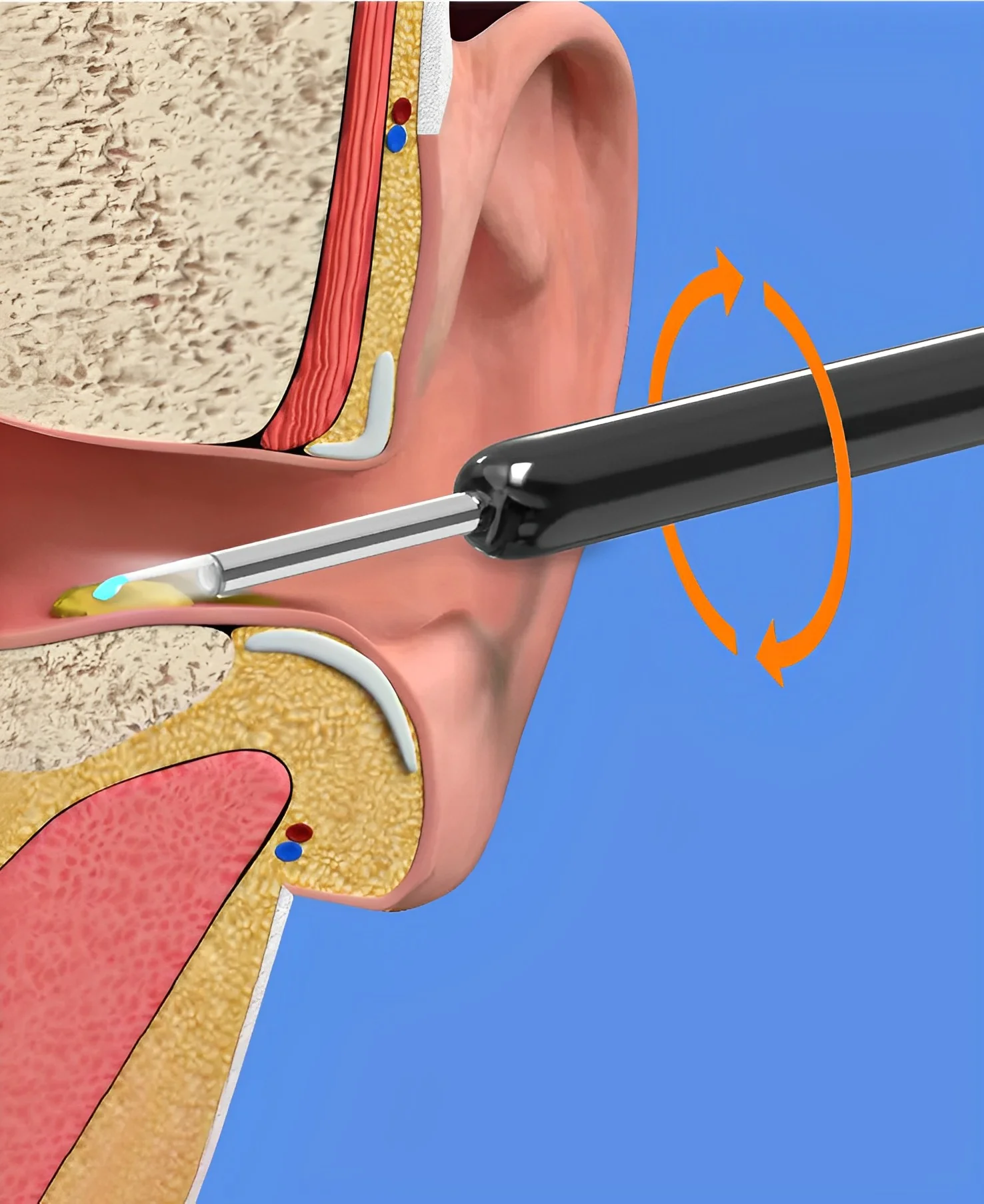 EarBit 3000 - Ear Cleaning Tool With a Camera - Image 4