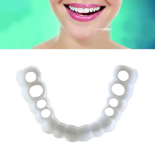 Facial Tooth Cover Retainer - Image 5