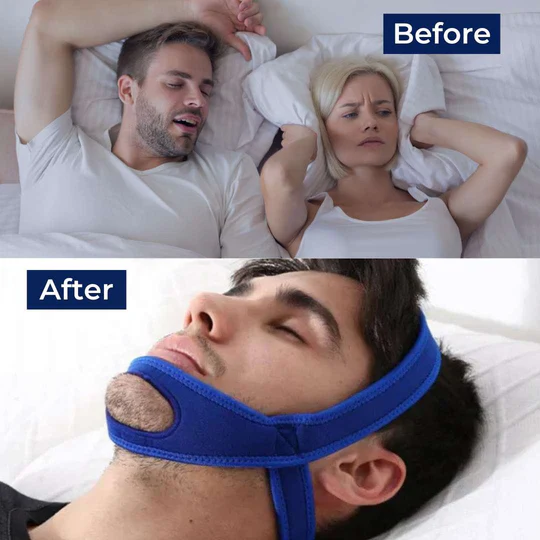 Full Head Chin Strap for Snoring Relief | Sleep Apnea Support - Comfortable - Night Use - Image 9