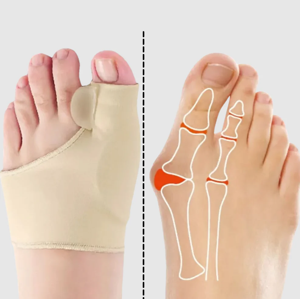 Gel bunion corrector - Image 3