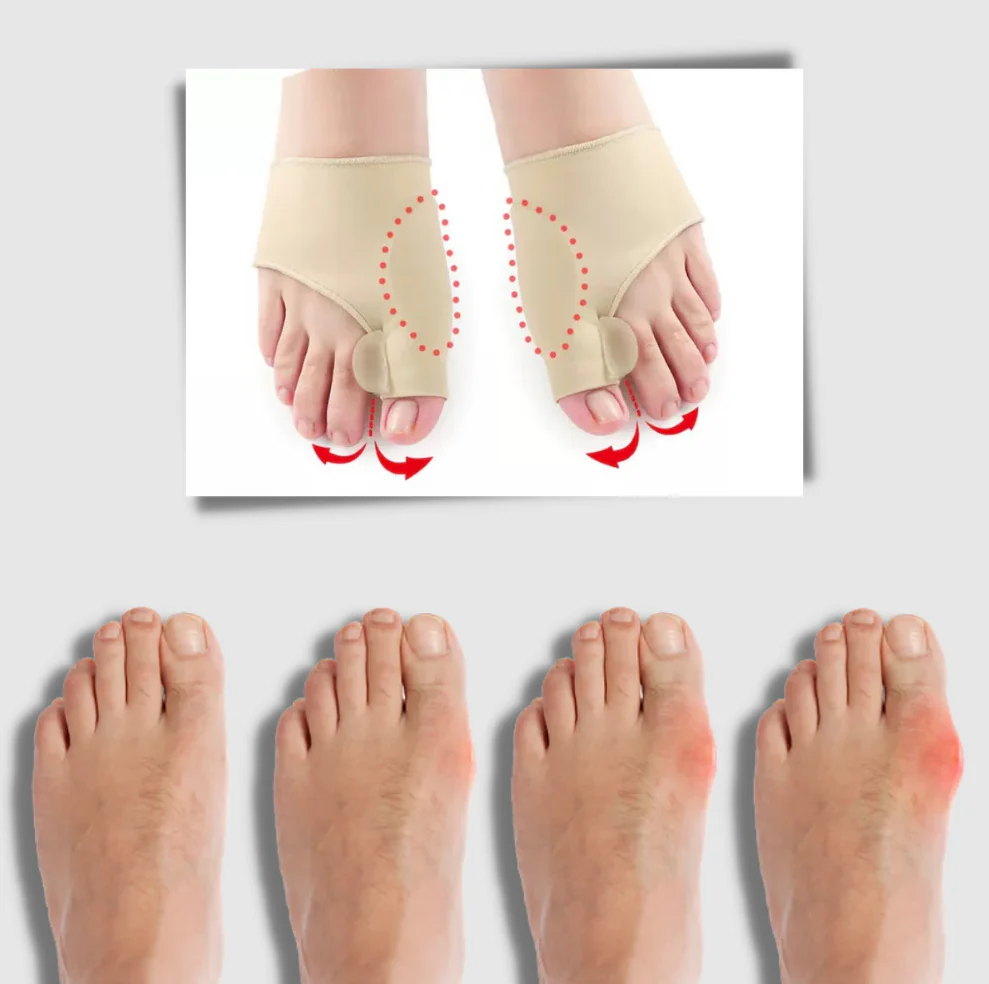 Gel bunion corrector - Image 4
