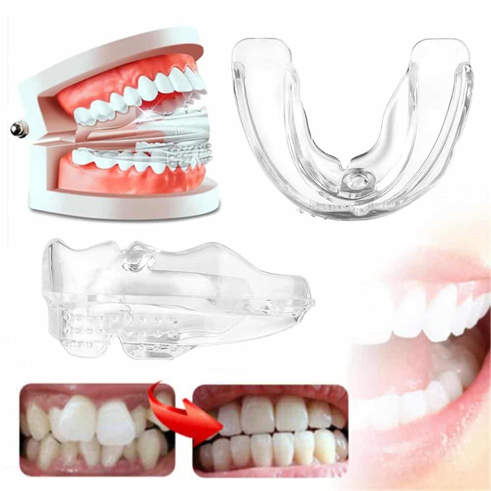 Invisible Dental Realignment Tray - Image 3