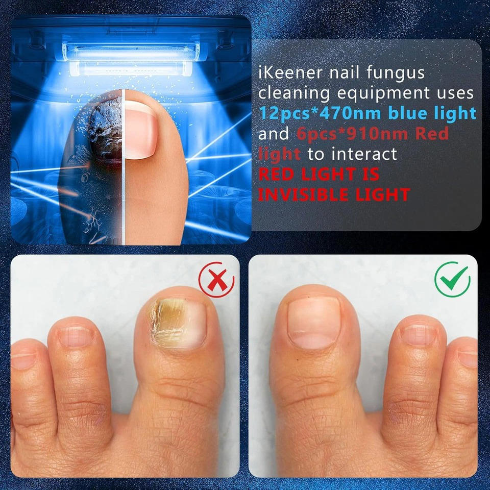 Nail Fungus Laser - Image 13