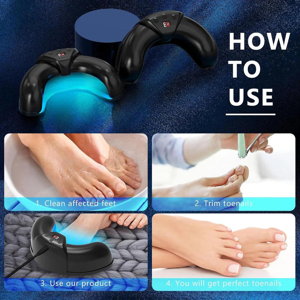 Nail Fungus Laser - Image 16