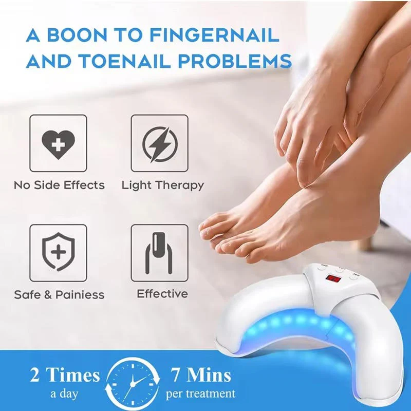 Nail Fungus Laser - Image 2