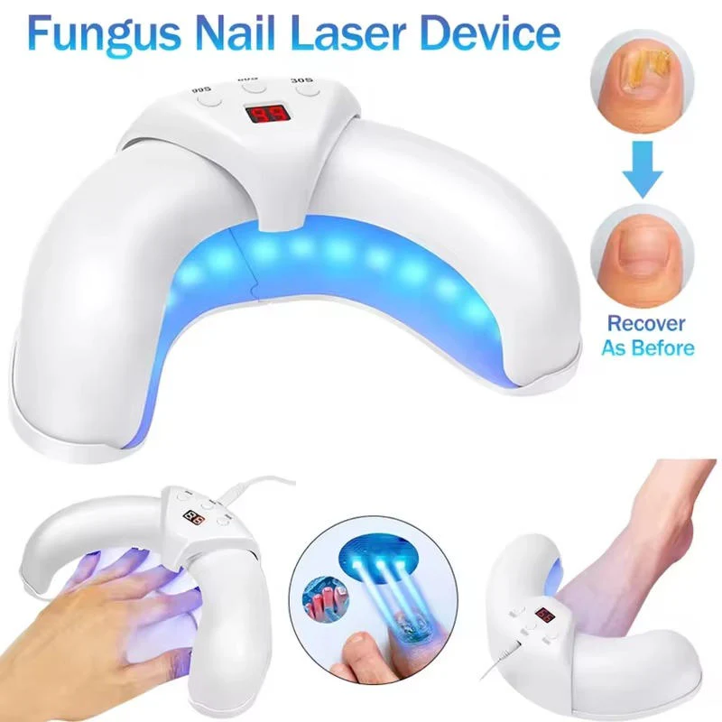 Nail Fungus Laser - Image 6