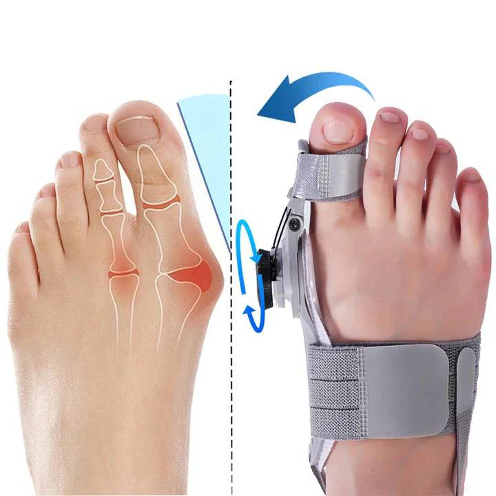 Natural Bunions Corrector Toe Spacer - Image 2