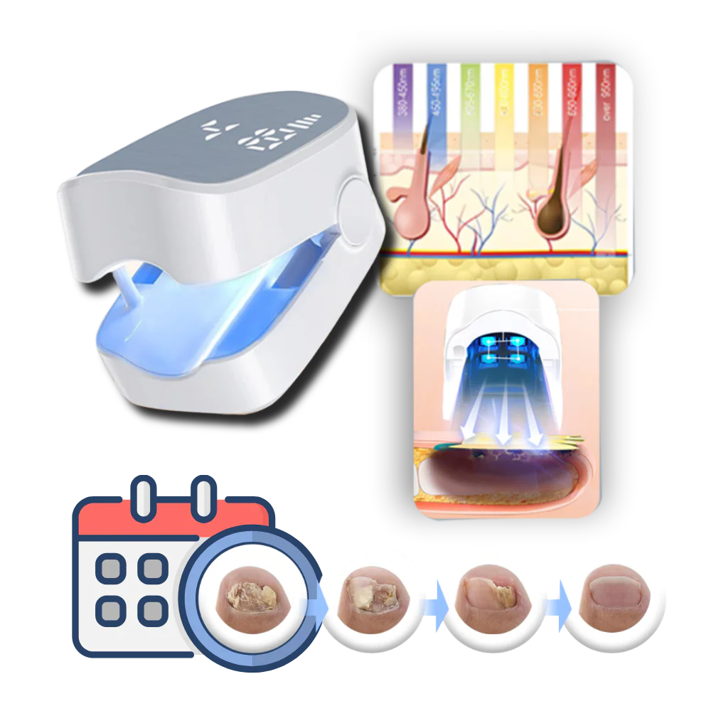 Painless laser treatment for nail fungus - Image 3