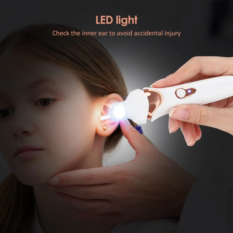 Painless Vacuum Ear Cleaner for Safe and Effective Use - Image 5