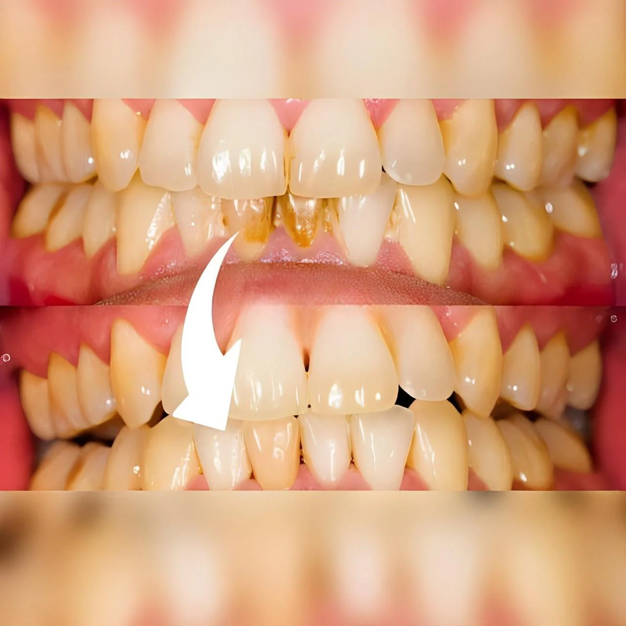 Professional Dental Scaler - Image 4