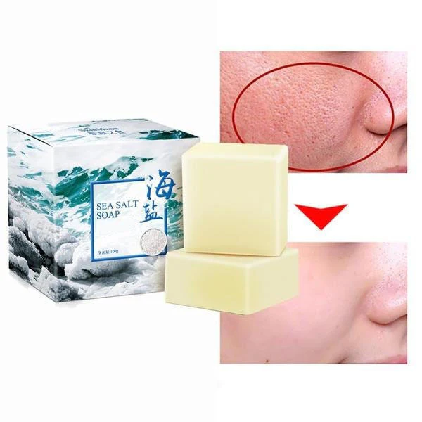 Sea Salt Soap - Acne Treatment - Image 3