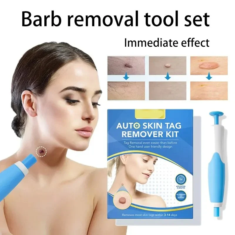 Skin Tag Removal Kit - Image 3