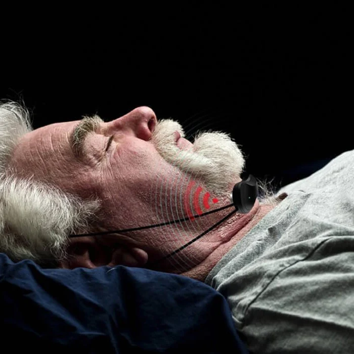Smart Anti-Snoring Device - Image 2