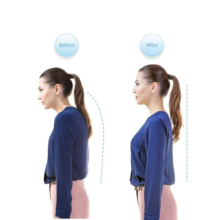 Smart Posture Corrector - Neck Hump Straightener Improve Your Posture for Adult and Kid - Image 5