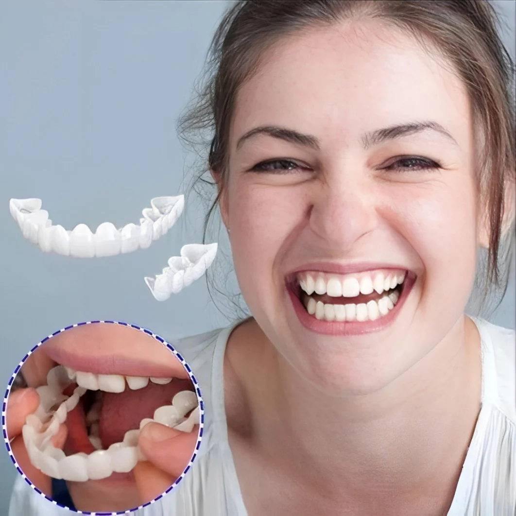 Smile Veneer (Upper & Lower Included) - Image 10