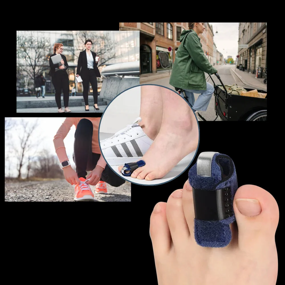Toe Straightener with Adjustable Support - Image 8