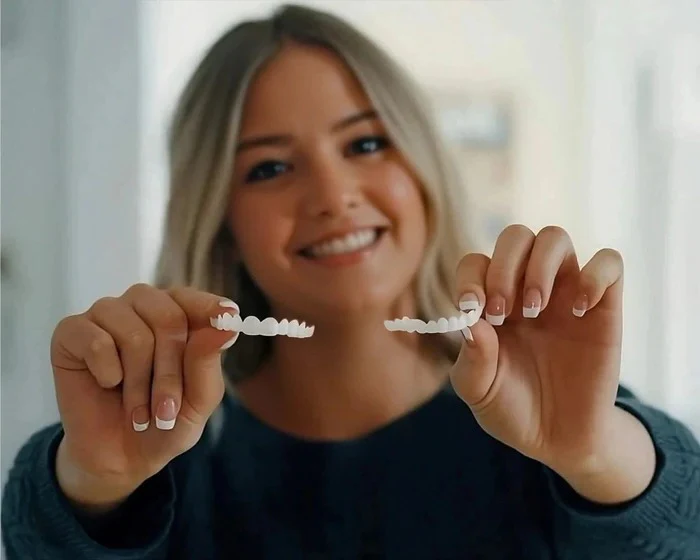 Veneers for Teeth with Natural White Finish - Image 2