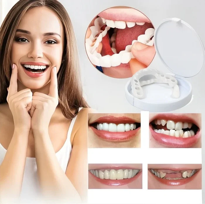 Veneers for Teeth with Natural White Finish - Image 7